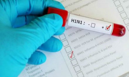 AUTORIDADES CONFIRMAN DOS MUERTES POR GRIPE A H1N1 Y UN PACIENTE EN ESTADO GRAVE