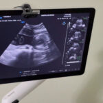 EL HOSPITAL DE ARTIGAS, REFERENCIA NACIONAL EN TELEMEDICINA